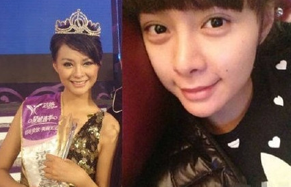 村姑变女神 网曝沈梦辰整容前旧照