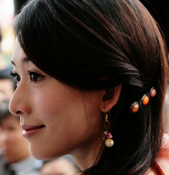 女星打玻尿酸过度脸变僵