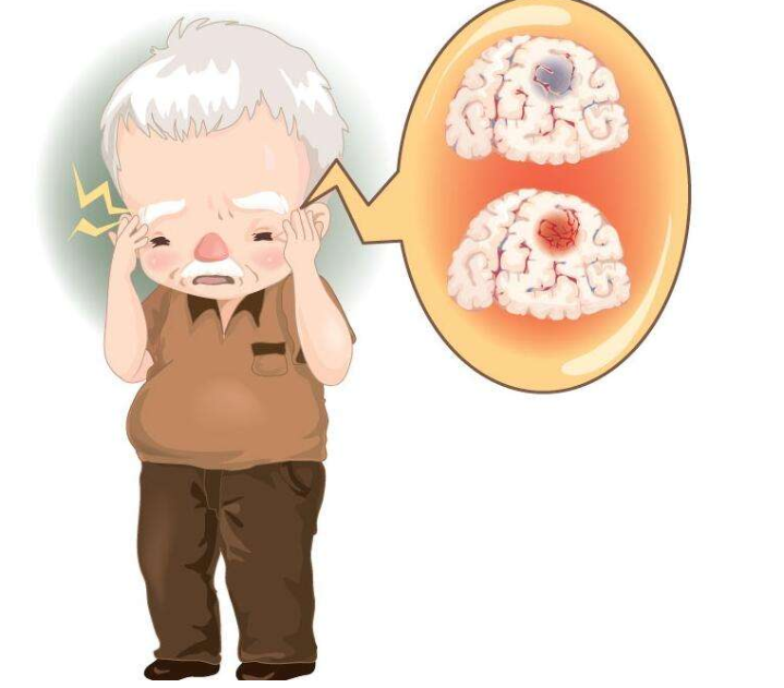 沈阳再增5家急性脑卒中医疗救治定点医院